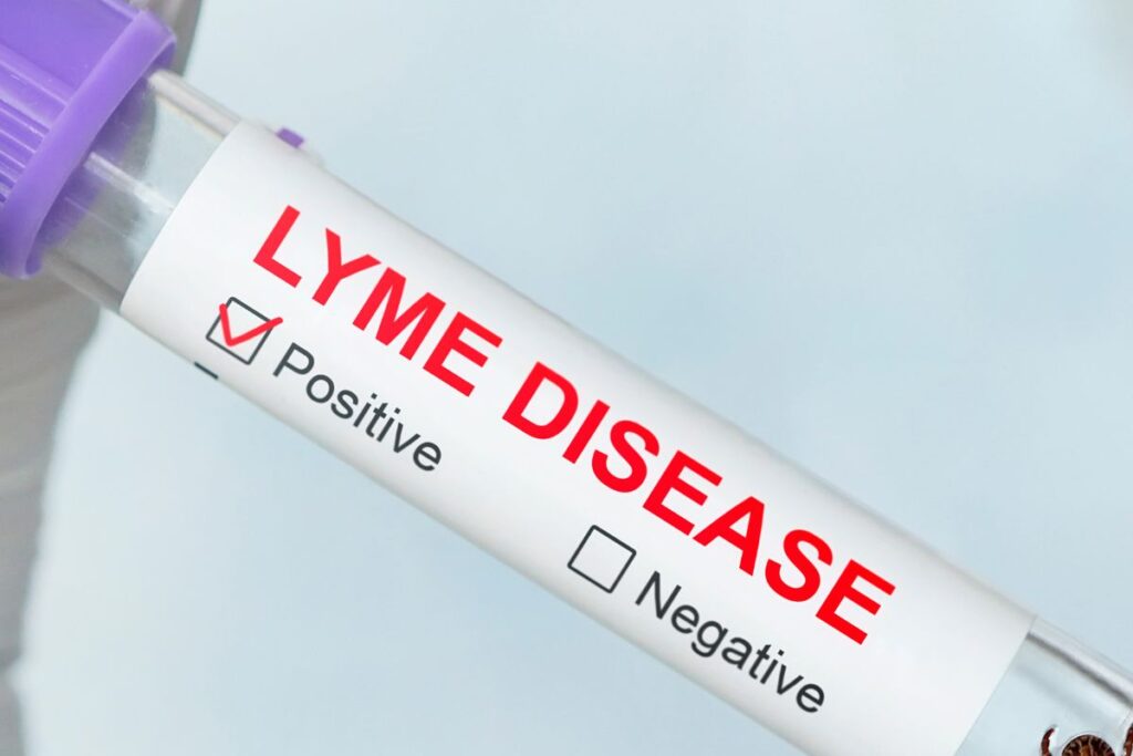 Lyme Disease